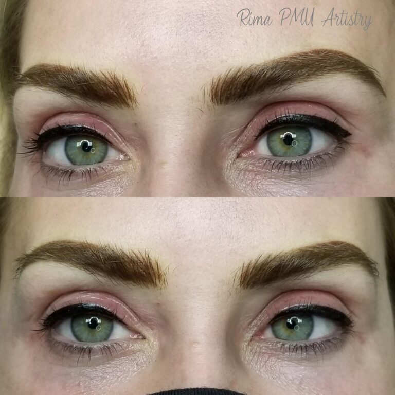 After Image: Combo Brow - left-front-oblique